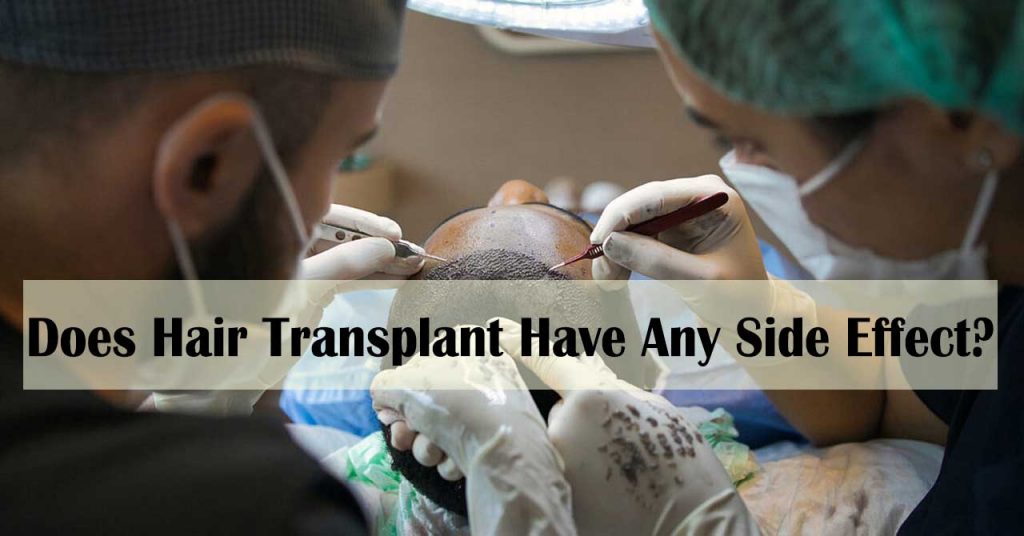 Does Hair Transplant Have Any Side Effect - hair transplant side effects cancer