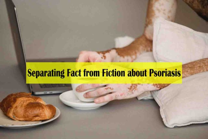 Uncovering the Myths Separating Fact from Fiction about Psoriasis