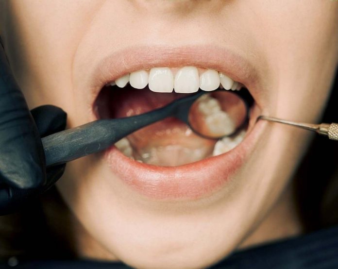 The Science Behind Oral Dental Probiotics: A Closer Look - oral probiotics