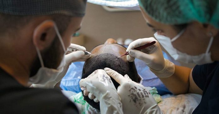 The Do's and Don'ts of Hair Transplant Aftercare - when can i rub my head after hair transplant